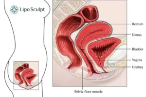 Treatment For A Leaky Bladder 2 How EM Chair treatment Glossop can help Leaky bladder issues. Read more now!